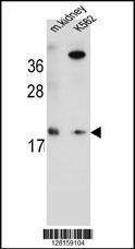 Anti-RN185 (Center) Antibody