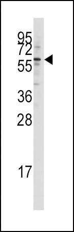 Anti-KAT5 / Tip60/HTATIP (N-term) Antibody