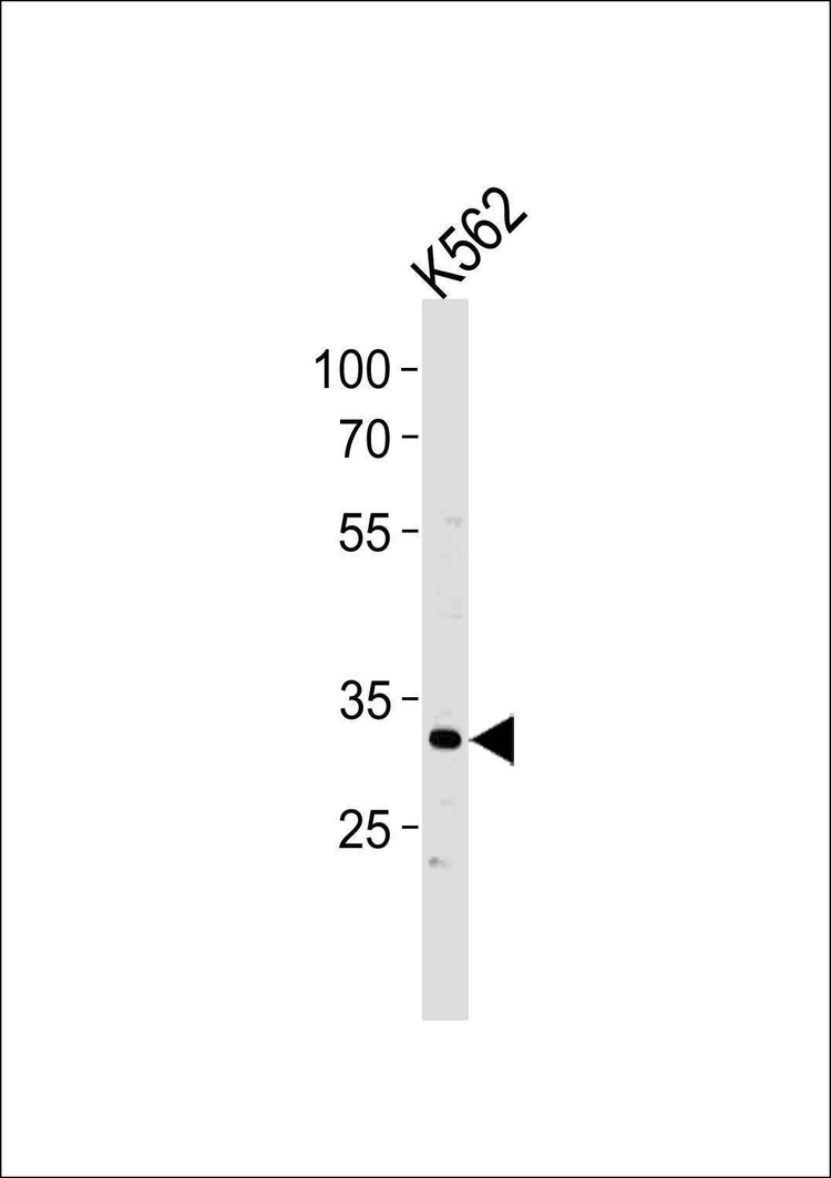 Anti-P5F1B (C-term) Antibody