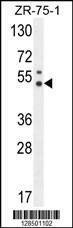 Anti-PUS3 (N-term) Antibody