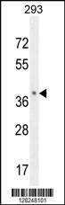 Anti-OR8B8 (C-term) Antibody