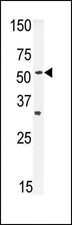Anti-ENT1 (C-term) Antibody