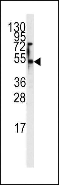 Anti-ENT1 (Slc29a1) (S254) Antibody
