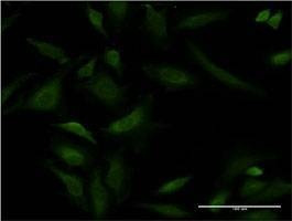 Anti-ATP2A1 Antibody