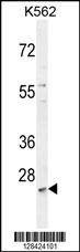 Anti-MCART2 (N-term) Antibody