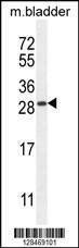 Anti-TIFAB (Center) Antibody