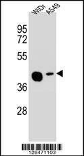 Anti-AMAC1L2 (N-term) Antibody