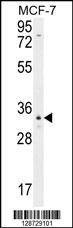 Anti-OR6C4 (C-term) Antibody