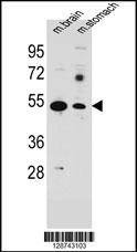 Anti-SLC16A11 (N-term) Antibody