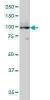 Anti-ATP2A3 Antibody