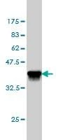 Anti-ATP2A3 Antibody