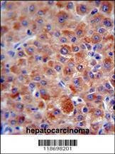 Anti-CFH (Center) Antibody