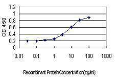 Anti-ATP2B1 Antibody