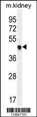 Anti-CDKN1C (N-term) Antibody