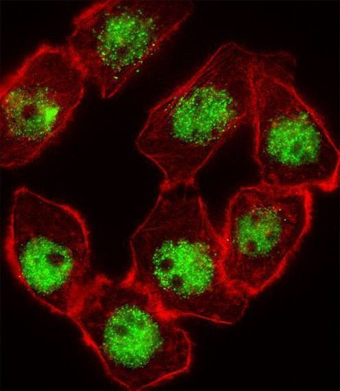 Anti-CDKN1C (N-term) Antibody