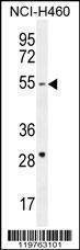 Anti-CD2BP2 (N-term) Antibody