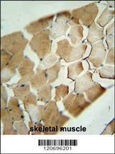 Anti-CDKN2C (C-term) Antibody