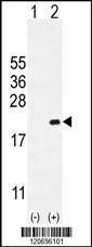 Anti-CDKN2C (C-term) Antibody