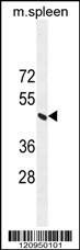 Anti-ERCC8 (Center) Antibody