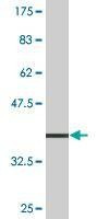 Anti-ATP4B Antibody