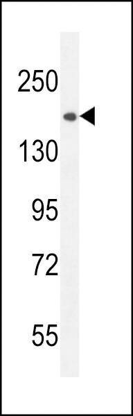 Anti-CE164 (N-term) Antibody
