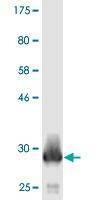 Anti-ATP5E Antibody