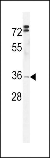 Anti-DC12 (C-term) Antibody