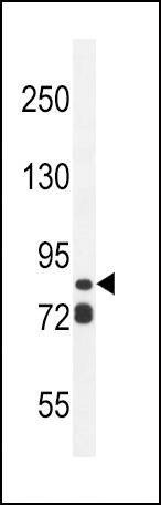 Anti-ASAP3 (N-term) Antibody