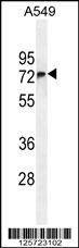Anti-FBXO24 (Center) Antibody