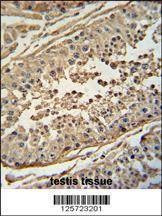 Anti-FBXO24 (Center) Antibody
