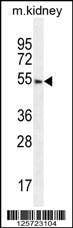 Anti-FBXO24 (Center) Antibody