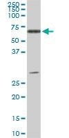 Anti-ATP6AP1 Antibody