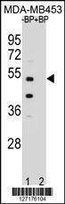 Anti-WDR51B (C-term) Antibody