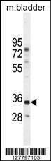 Anti-C17orf59 (Center) Antibody
