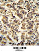 Anti-TTC39B (C-term) Antibody