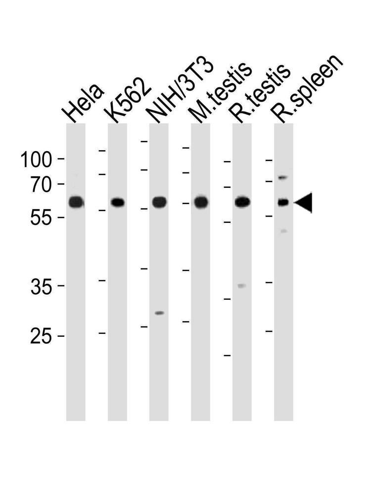 Anti-HDAC1 (N-term) Antibody