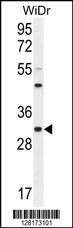 Anti-RILPL2 (Center) Antibody