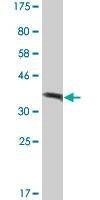 Anti-ATP6V1A Antibody