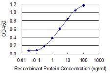 Anti-ATP6V1A Antibody