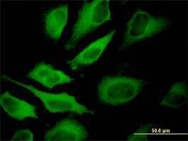Anti-ATP6V1A Antibody