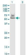 Anti-ATP6V1A Antibody
