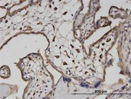 Anti-ATP6V1A Antibody