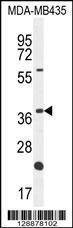 Anti-OR6V1 (C-term) Antibody