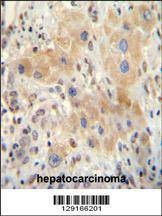 Anti-NR0B2 (Center) Antibody