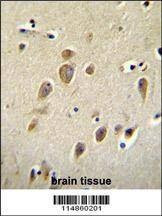 Anti-RARS (C-term) Antibody