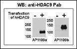 Anti-HDAC9 (N-term) Antibody