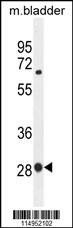 Anti-BTF3 (N-term) Antibody
