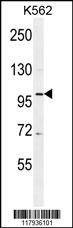 Anti-DDX27 (C-term) Antibody
