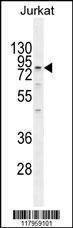 Anti-ELMO2 (Center) Antibody