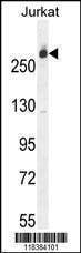 Anti-CAD (Center) Antibody